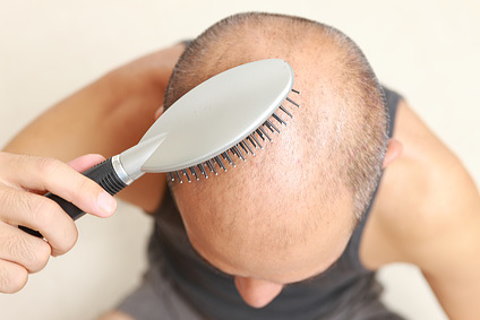 発毛は年齢的に手遅れだと諦めつつ、薄毛を気にする中年男性